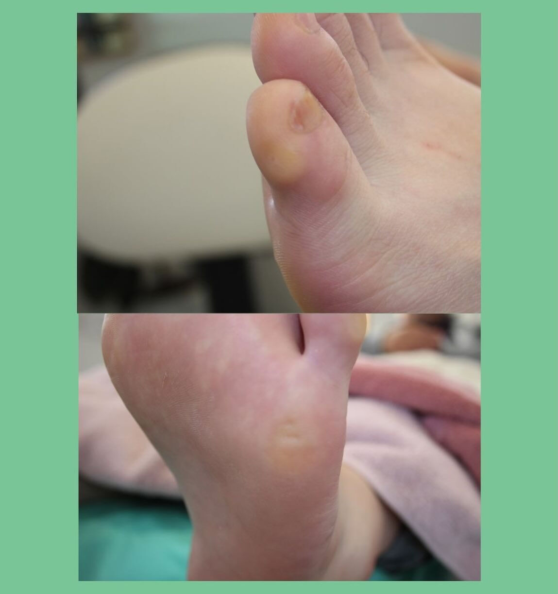 フットトータルコースのお客さま👣
