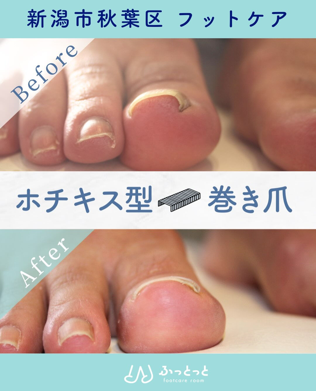 footcare room ふっとっとです😊😊