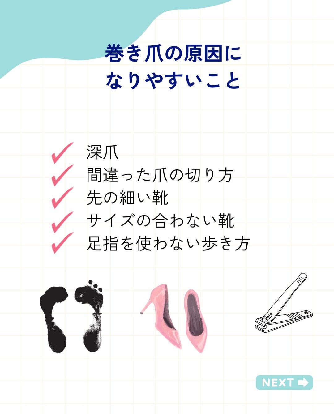 巻き爪ってなに？