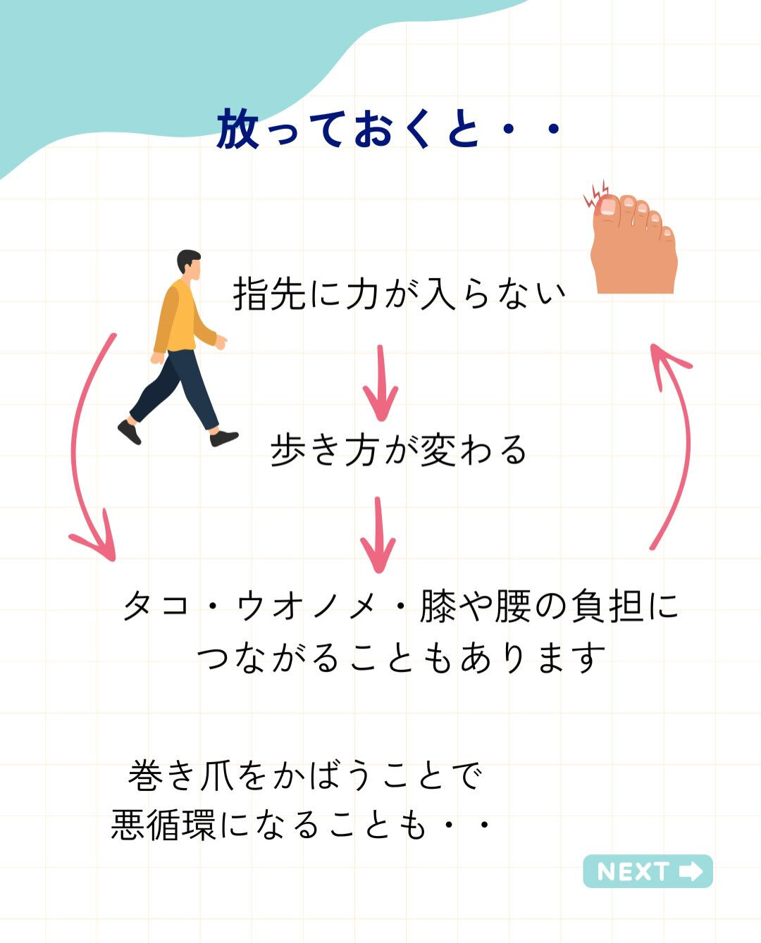 巻き爪ってなに？