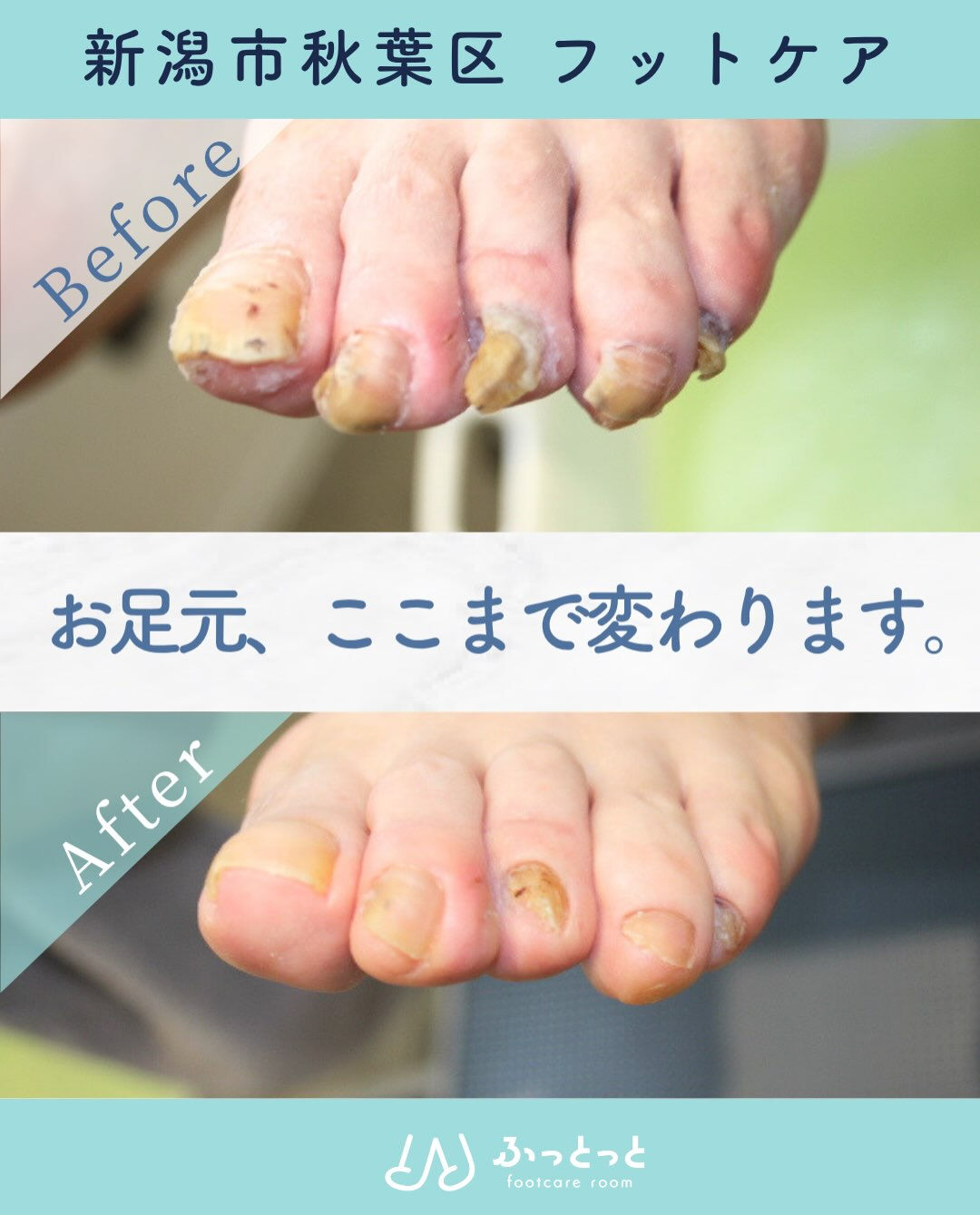 footcare room ふっとっとです☺️