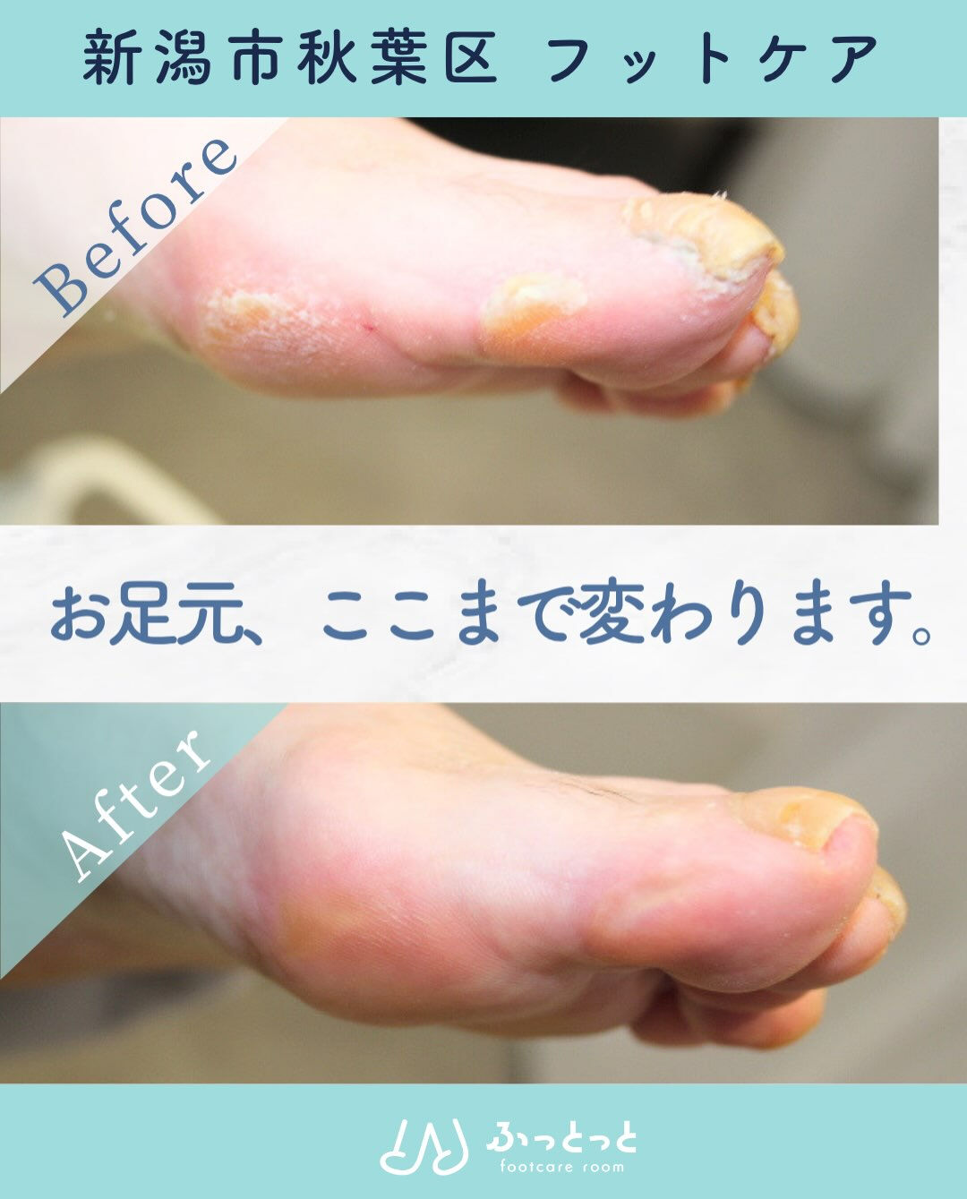 footcare room ふっとっとです☺️