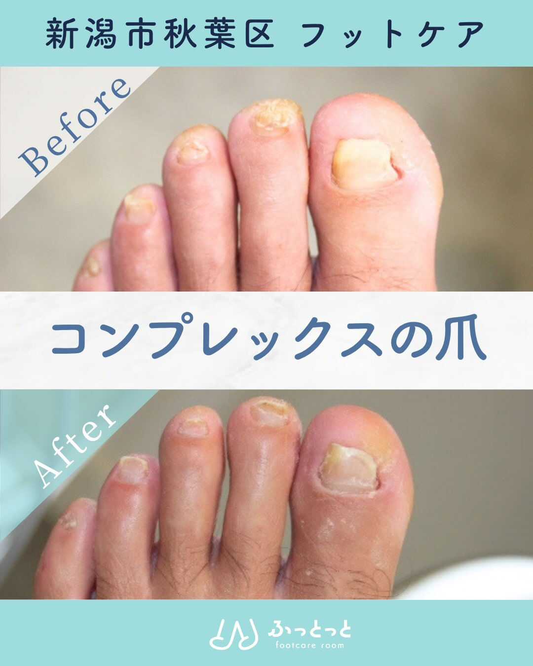 「ずっと爪の形が気になっていたし、