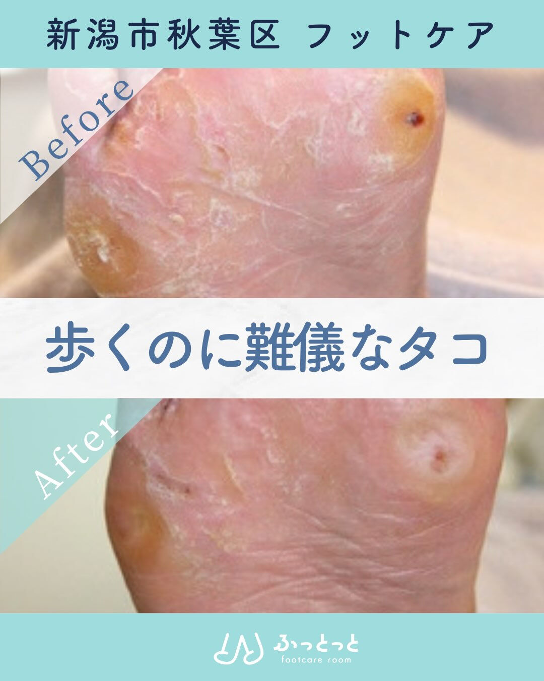 「ずっと爪の形が気になっていたし、
